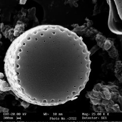 Diatomée (Aulacoseira alpigena) observée au microscope (E. Falasco)